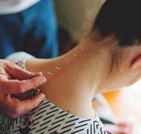 Scott Martin Acupuncture - Internet Find