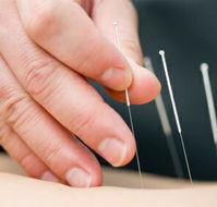 Kingscliff Acupuncture  Massage - Internet Find