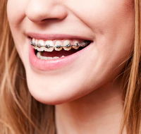Cairns Specialist Orthodontists - Internet Find