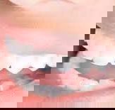 Ramana HarryDental Prosthetist - Internet Find