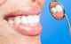 Fannie Bay Dental Surgery - thumb 4