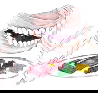 Dannalees Mobile Denture Service - Internet Find