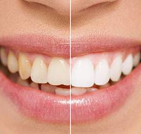 Newcastle Dental Care - Internet Find