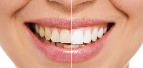 Newcastle Dental Care - Internet Find 0