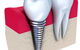 Honeysuckle Dental - thumb 5