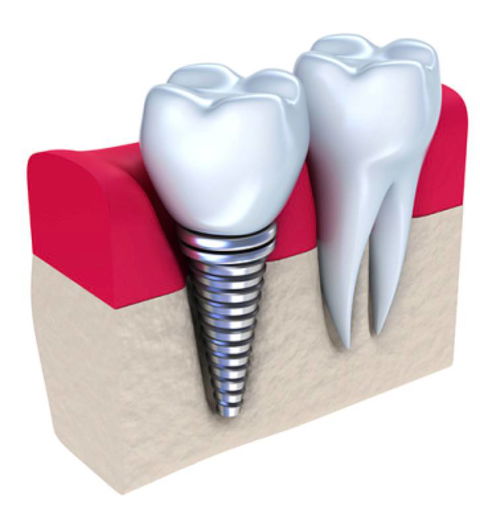 Honeysuckle Dental - Internet Find 5