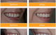 Honeysuckle Dental - thumb 6