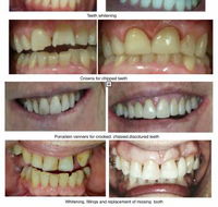 Smile Craft Dental - Internet Find