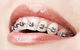 Dental Centre Buderim - thumb 3