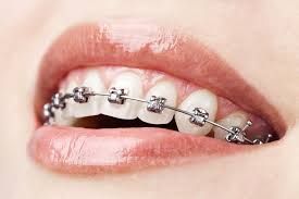 Dental Centre Buderim - Internet Find 3