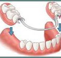Denture Success - Internet Find