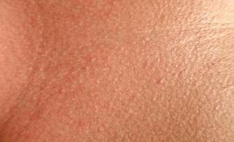 Alice Specialised Medicine - Internet Find 1