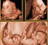 Sarina Medical Imaging - Internet Find