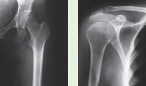 Diabetes Association Northern Territory - Internet Find 3